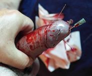 different Needles in Cock Cockhead (censored)