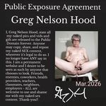 Greg Nelson Hood - Exposed