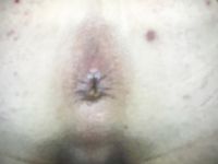 Pee and Asshole