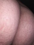 My Butt