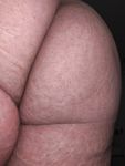 My Butt