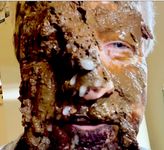 The Degradation of Human Garbage