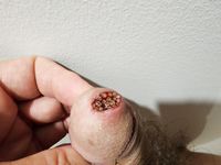 Michel dube full naked with cock full of worms