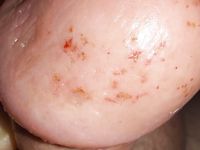 Futter für  hungrige maggots  extrem pervers