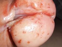 Futter für  hungrige maggots  extrem pervers