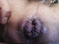 My hungry prolapsed anal cunt
