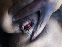 My hungry prolapsed anal cunt