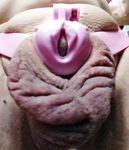 Completely without a penis and testicles, everything pushed