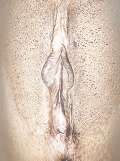 Arunakalinjarnude  2