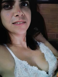 Cassia Anal Prolapse Ass