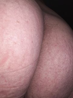 My Butt