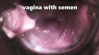 we love it when you watch our genitals work