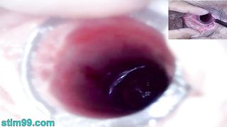 Lesbians Extreme Cervix Play and Peehole Fucking Penis Dildo