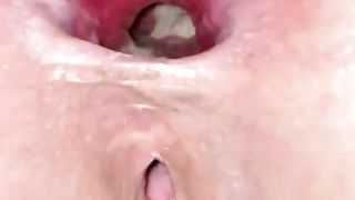 Anal Gape after Fucking