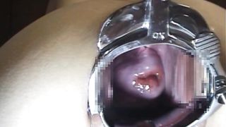 Extreme pussy stretching, Cervix in closeup