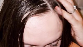 Extreme prolapse close up