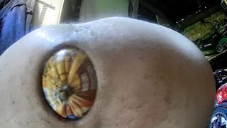 Anal training & rectal prolapse