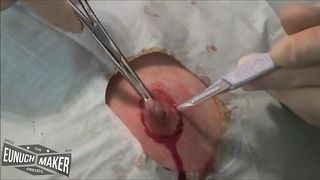 Nipple surgery
