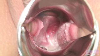 asian whore gape pissing and shit