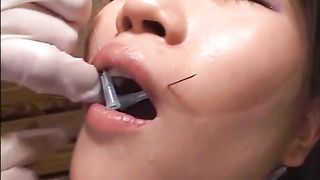 Face needle
