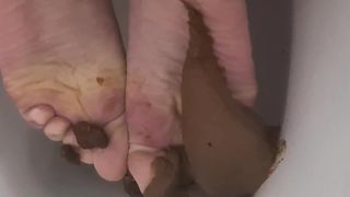 Shitting on my feet