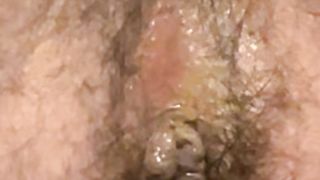 Playing with my ass clit