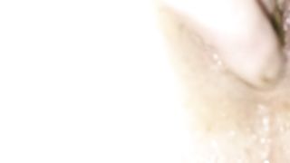 French scat prolapse