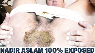 Exposing my hairy unwiped asshole!