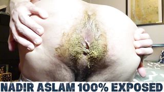 ULTIMATE UNWIPED ASSHOLE COMPILATION