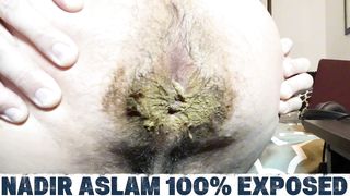 ULTIMATE UNWIPED ASSHOLE COMPILATION