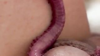 Worms in urethra insertion