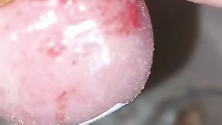 Bizarre cbt insertion bdsm pervers maden