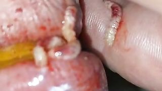 Bizarre cbt insertion bdsm pervers maden