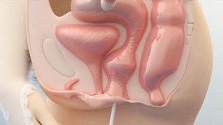 Female masturbation sounding pt 2