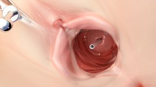 Female masturbation sounding pt 2