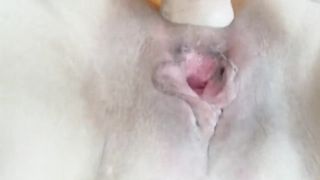 Cassia Anal Prolapse Ass Fist