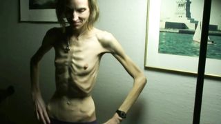 Skin and bones
