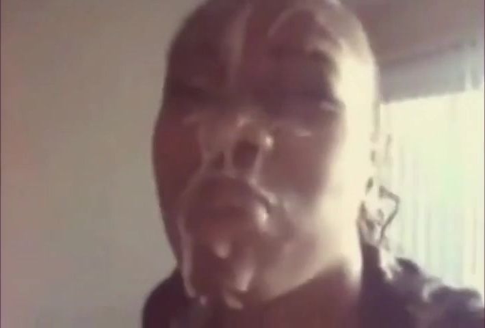 Nut face