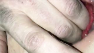 Gape after deep fisting