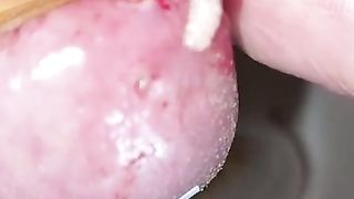 Bizarre cbt insertion bdsm pervers insect