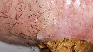 Kitty Skatt toilet shit