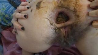 Scat Gaping