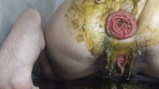 Messy Prolapse