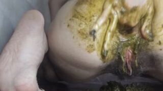 Messy Prolapse